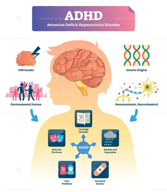 ADHD vector illustration