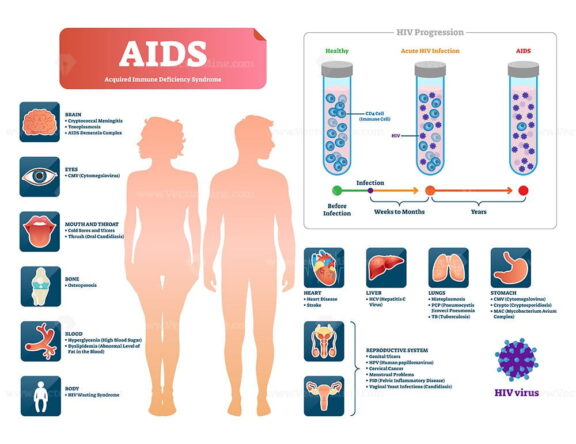 AIDS or HIV vector illustration