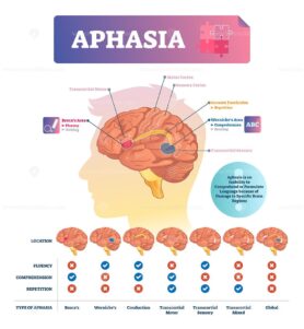 Aphasia vector illustration