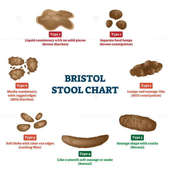 Bristol Stool Chart