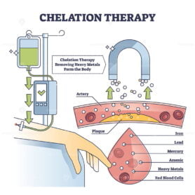 Chelation therapy for toxic heavy metal medical treatment outline diagram