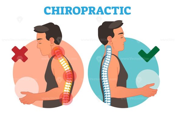FREE Chiropractic conceptual vector illustration