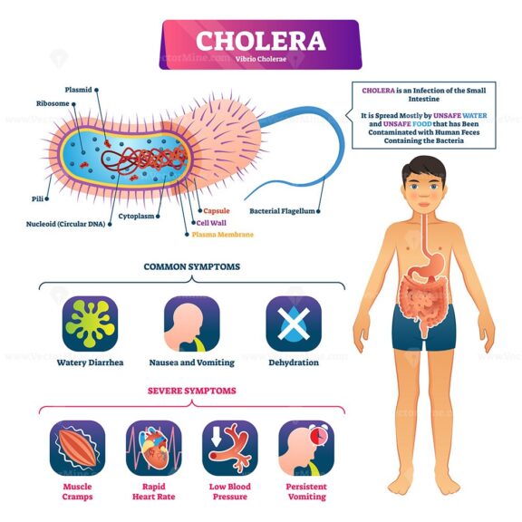 Cholera vector illustration