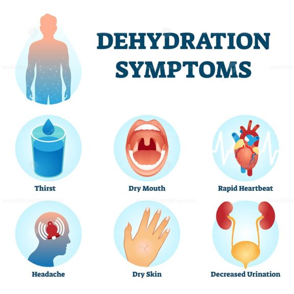 Dehydration symptoms vector illustration