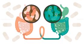 Fecal microbiota transplant (FMT) or stool transplant procedure concept