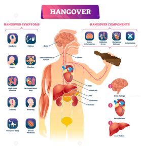 Hangover vector illustration