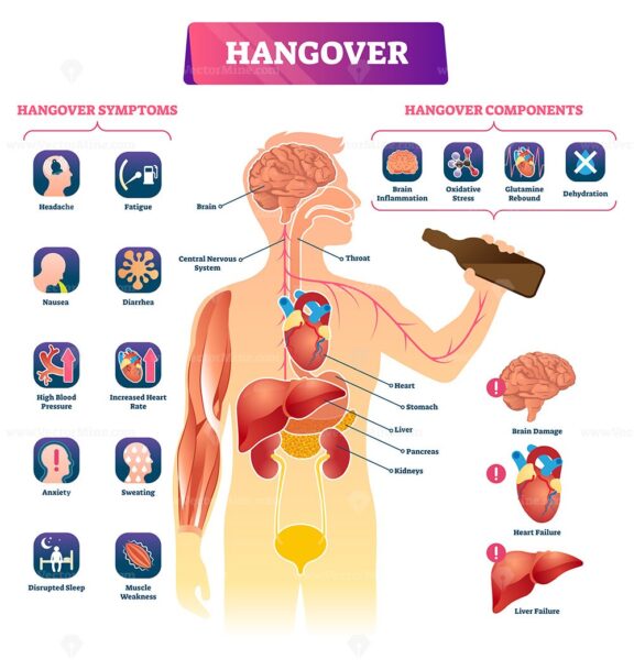 Hangover vector illustration