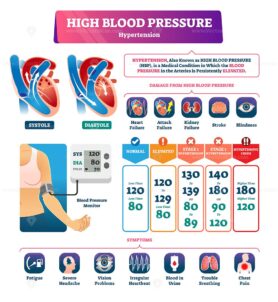 High blood pressure vector illustration