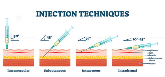 Injection techniques vector illustration