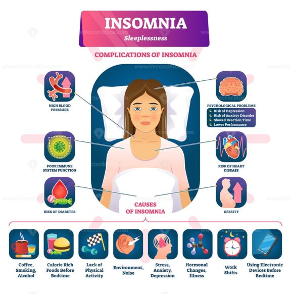 Insomnia vector illustration