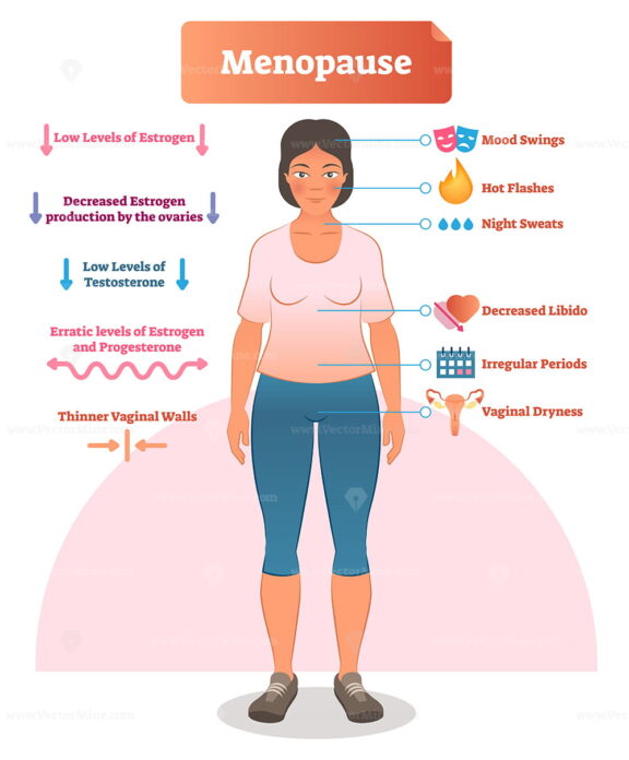 Menopause labeled vector illustration