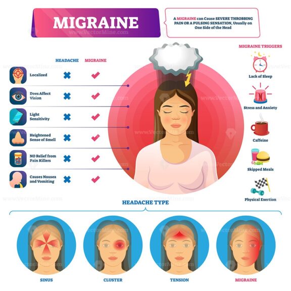 Migraine vector illustration