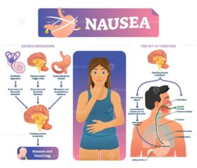 Nausea vector illustration
