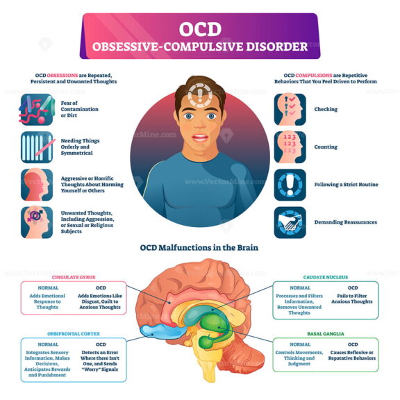 OCD obsessive compulsive disorder labeled explanation vector illustration