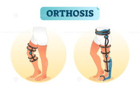 Human leg orthosis medical equipment vector illustration
