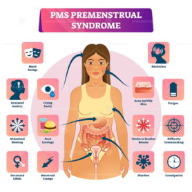 PMS or Premenstrual Syndrome vector illustration anatomical symptom scheme