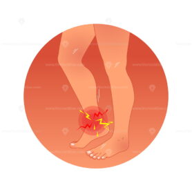 FREE Painful ankle concept vector illustration