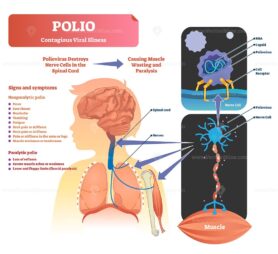 Polio vector illustration
