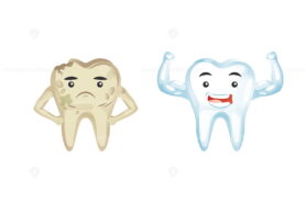 FREE Teeth plaque and dental whitening with before and after result comparison
