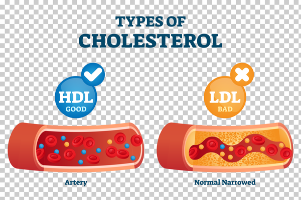 Cholesterol types comparison with HDL and LDL lipoprotein vector illustration - Image 2
