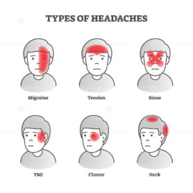 FREE Types of headaches vector illustration