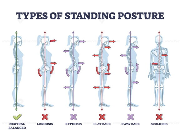 Types of standing postures and medical back pathology set outline diagram