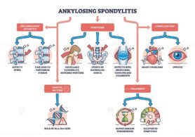 Ankylosing spondylitis as arthritis symptoms or complications outline diagram