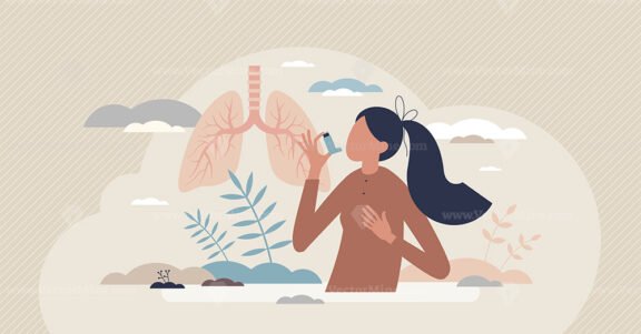 Asthma chronic disease with medical breathing problems tiny person concept