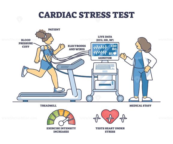 Cardiac stress test diagram shows a patient on a treadmill with electrodes, monitored by medical staff for heart activity. Outline diagram