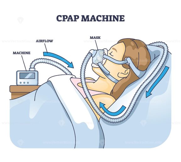 CPAP machine diagram shows airflow, mask, and machine connection. Outline diagram.