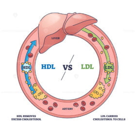 Good HDL and bad LDL cholesterol movement comparison outline diagram