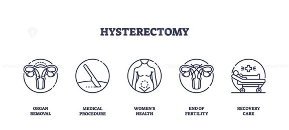 Hysterectomy icons outline the uterus, surgical tools, and recovery bed, symbolizing organ removal, medical procedure, and post-surgery care. Outline icons set