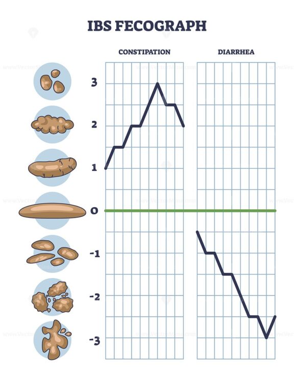 IBS fecograph as daily bristol stool form representation outline diagram