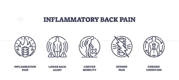 Inflammatory back pain is depicted with icons showing spine inflammation, limited mobility, and sudden pain. Outline icons set.