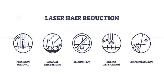 Laser hair reduction is illustrated with outline icons showing hair removal, skin, and laser beams, representing precision and transformation. Outline icons set