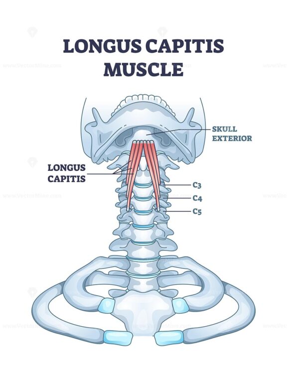 Longus capitis muscle anatomy is shown with labeled cervical vertebrae and skull base, highlighting muscle location. Outline diagram