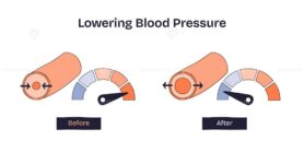 Lowering blood pressure is shown by comparing narrowed and widened blood vessels with gauge indicators before and after. Doodle style diagram
