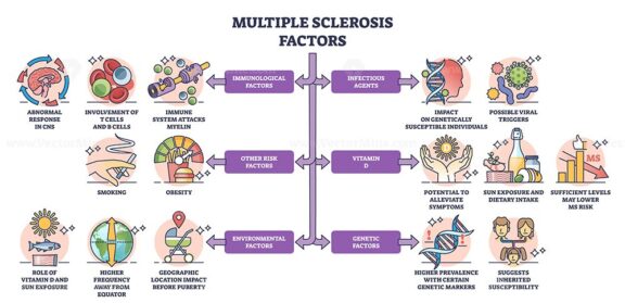Multiple sclerosis factors as MS disease risks and causes outline diagram