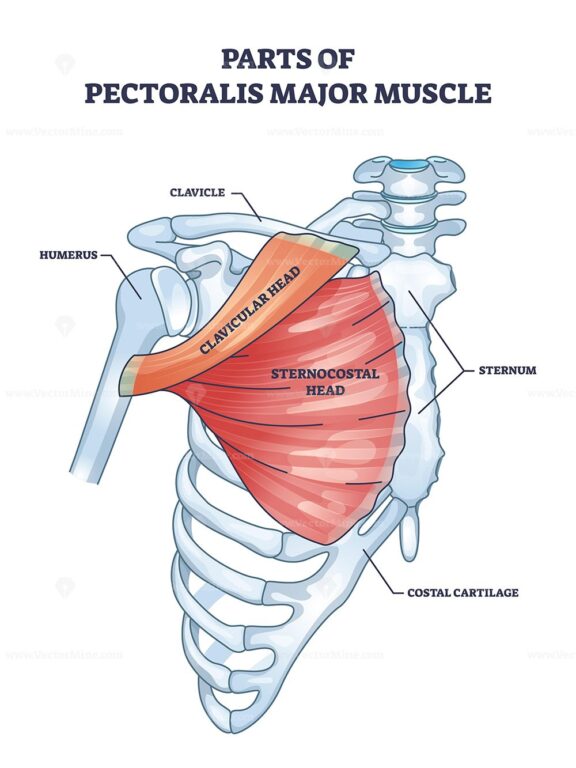The diagram outlines parts of the pectoralis major muscle, highlighting the clavicular and sternocostal heads. Outline diagram