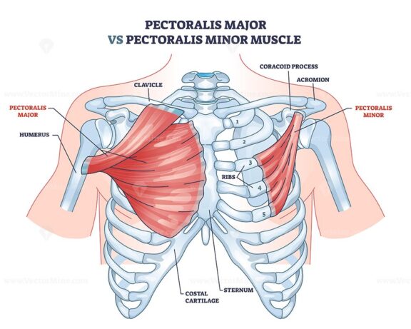 The diagram contrasts pectoralis major and minor muscles, highlighting their anatomical positions. Outline diagram