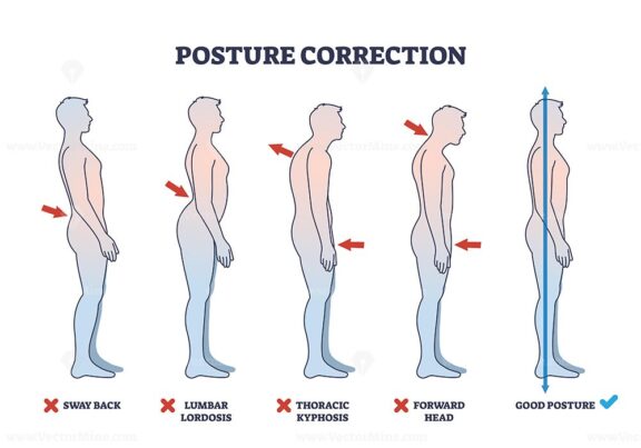 Posture correction diagram shows five side-view silhouettes illustrating various spine alignments. Key objects, silhouettes, arrows, spine. Outline diagram