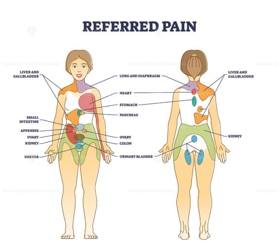 Referred pain location as body painful stimulus organ origin outline diagram