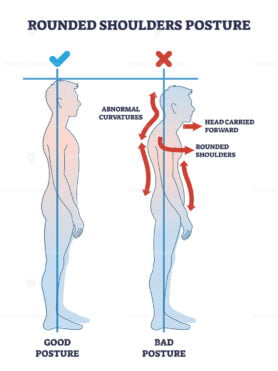 Rounded shoulders posture with body alignment forward outline diagram