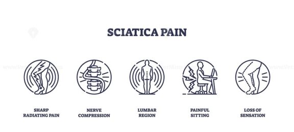 Sciatica pain is depicted with icons showing nerve compression, lumbar region, and painful sitting. Outline icons set.