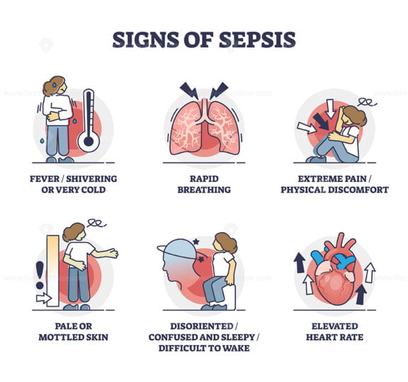 Signs of sepsis as infection blood poisoning symptoms outline collection