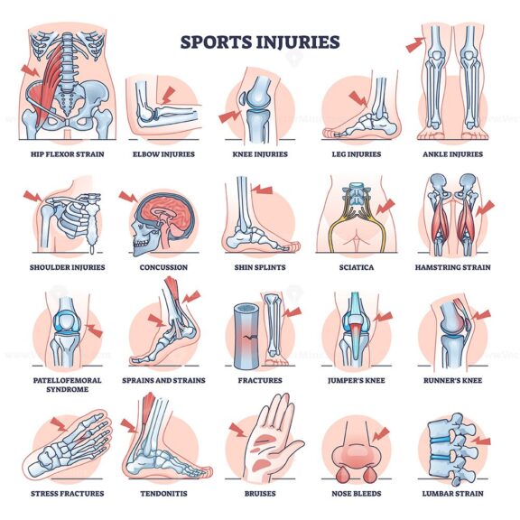 Sports injuries and most common athlete traumas outline collection set