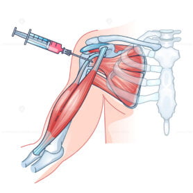 Stem cell therapy as regenerative medicine for tissue repair outline diagram