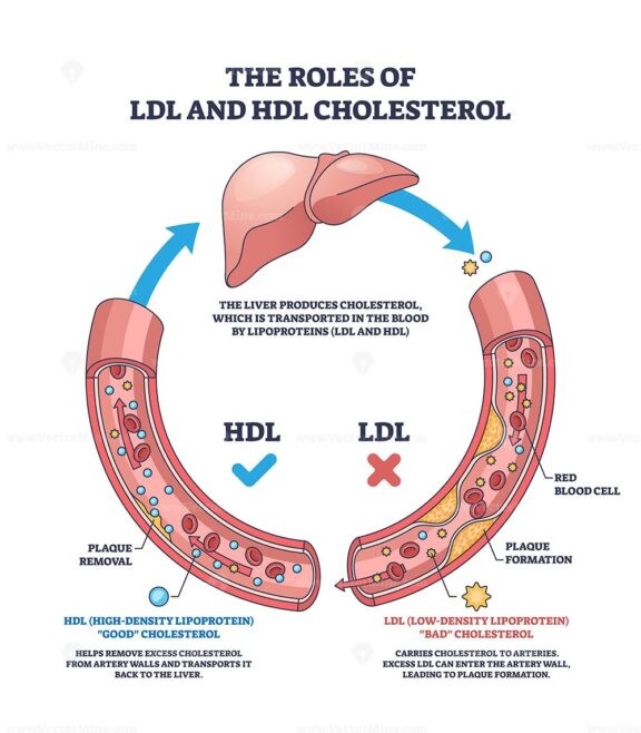 The roles of LDL and HDL cholesterol are shown with a liver, blood vessels, and cholesterol particles, highlighting cholesterol transport and plaque formation. Outline diagram